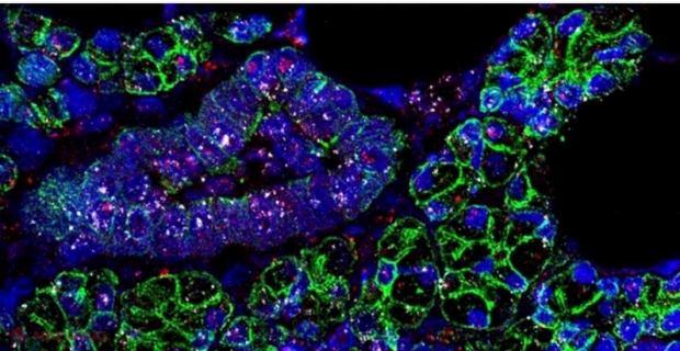 „Arma secretă” a variantei Delta a noului coronavirus. De ce este atât de contagioasă?