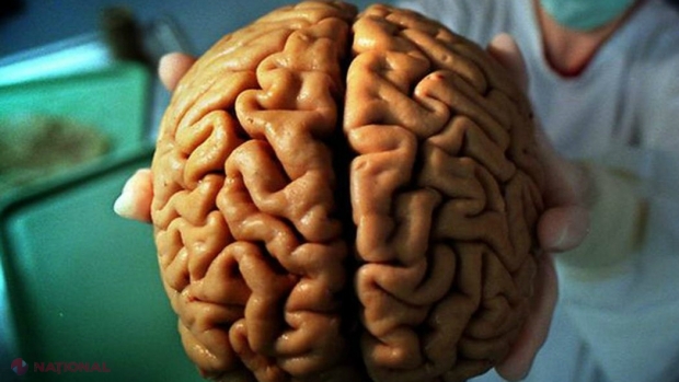 Efectele SARS-CoV-2: Creierul uman, mai bătrân cu până la 10 ani după COVID-19. Ce arată rezultatele unui studiu despre deficitul cognitiv