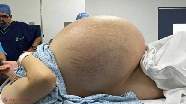 Când a ajuns la spital, medicii au zis că e însărcinată. Fata a negat. Ce i-au găsit în burtă