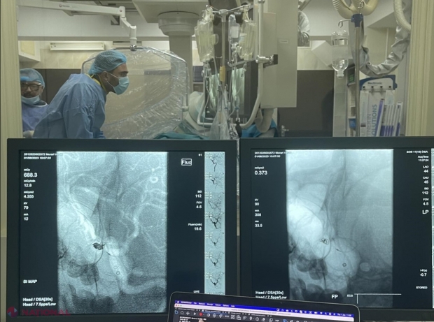 Neurochirurgii și chirurgii endovasculari de la Institutul de Medicină Urgentă au readus de pe lumea cealaltă un tânăr de 27 de ani. Aceștia au folosit tehnica minim invazivă, iar pacientul a fost EXTERNAT după o săptămână