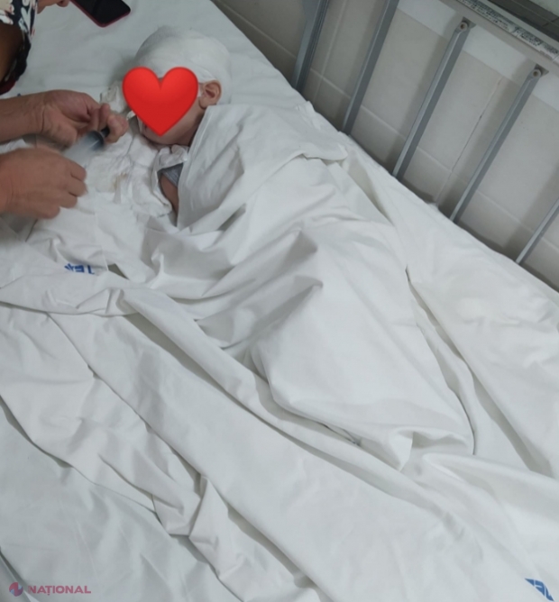 APEL DISPERAT pentru a acorda AJUTOR unui micuț de doar doi ani din Cantemir, rămas fără o bucată de cap: Este internat la Institutul Mamei și Copilului din Chișinău cu bunica, după ce mama sa, din cauza stresului, a născut doi bebeluși morți 