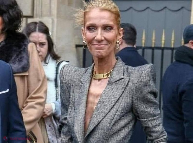 Celine Dion suferă de distrofie musculară. A ajuns la 40 de kilograme și nu mai poate să meargă