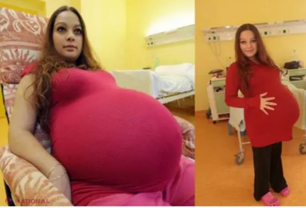 A intrat in istorie! Ce-a putut să nască Alexandra, o tânăra de doar 23 de ani! Peste 40 de medici și-au făcut cruce în jurul ei