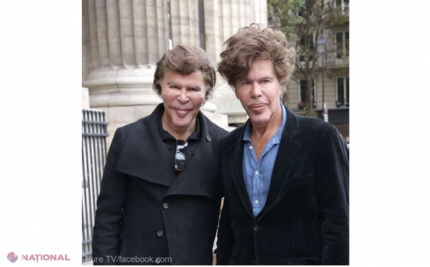 VIDEO // Cei mai faimoși gemeni din Franța au murit la o distanță de șase zile unul de altul