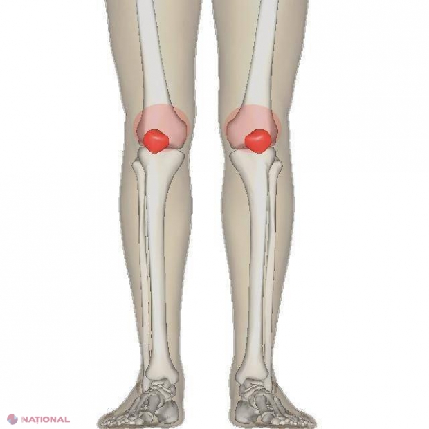 injecții în articulațiile cotului pentru durere cum să mușească durerea de genunchi