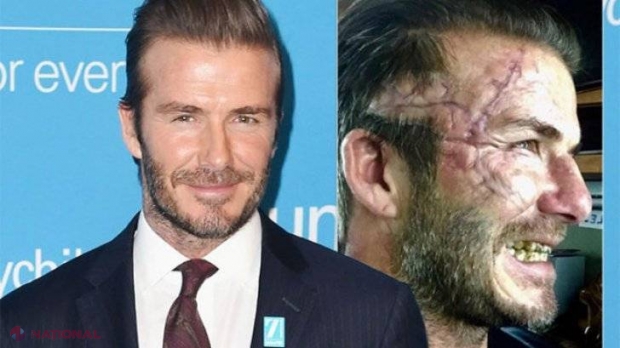 Dezvăluiri: David Beckham are probleme psihice