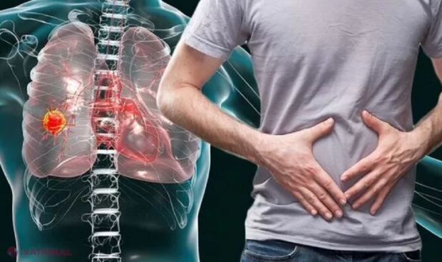 VIDEO // „Chirurgia nu vindecă cancerul, mai ales etapa III”. Un bărbat s-a VINDECAT fără ajutorul medicilor, după ce a refuza chimioterapia. Cum a reușit?