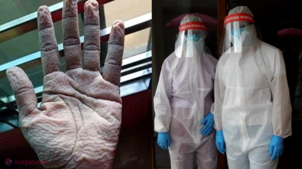 FOTO // Imagini impresionante ale efectelor pe care le au echipamentele de protecție asupra medicilor din prima linie „A sta îmbrăcat în acel costum te costă”