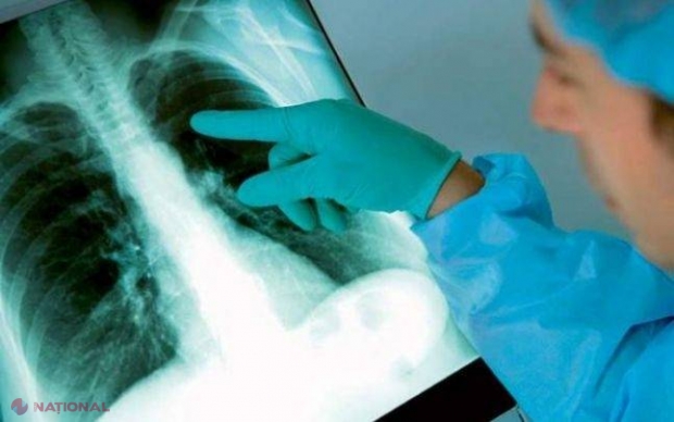TUBERCULOZĂ la o grădiniță din Chișinău