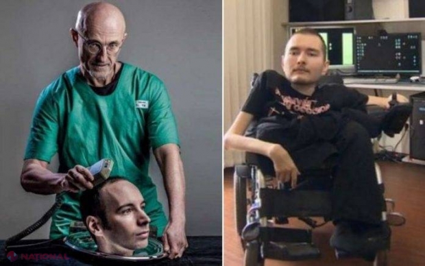 Un pas uriaş pentru medicină! Primul TRANSPLANT de CAP uman din istorie va fi realizat peste 2 luni