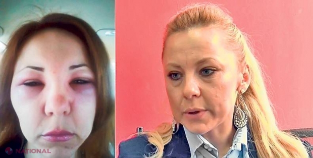 DRAMĂ // O avocată a fost injectată cu venin