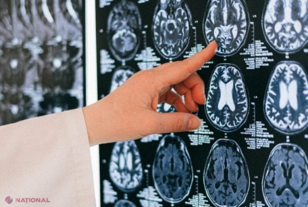 Neurocercetătorii dezvăluie secretele uitării: de ce creierul nostru păstrează amintiri utile și le uită pe cele irelevante