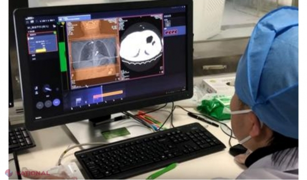 IMAGINI DE GROAZĂ cu plămânii bolnavilor infectați cu coronavirus. Cercetătorii chinezi arată cum, în cazuri severe, pe CT apare plămânul „complet alb”