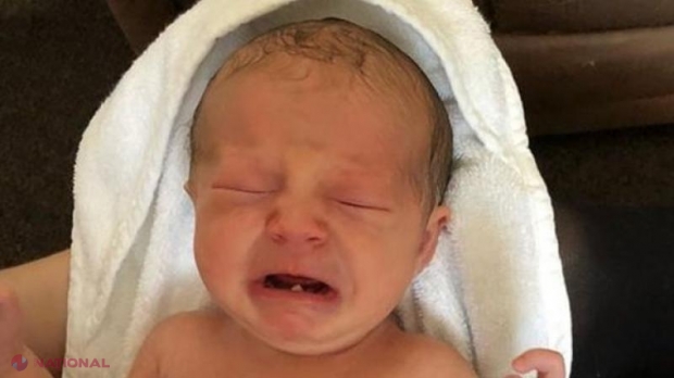 Unui bebeluș în vârstă de 12 zile a trebuit să îi fie scos dintele cu care s-a născut