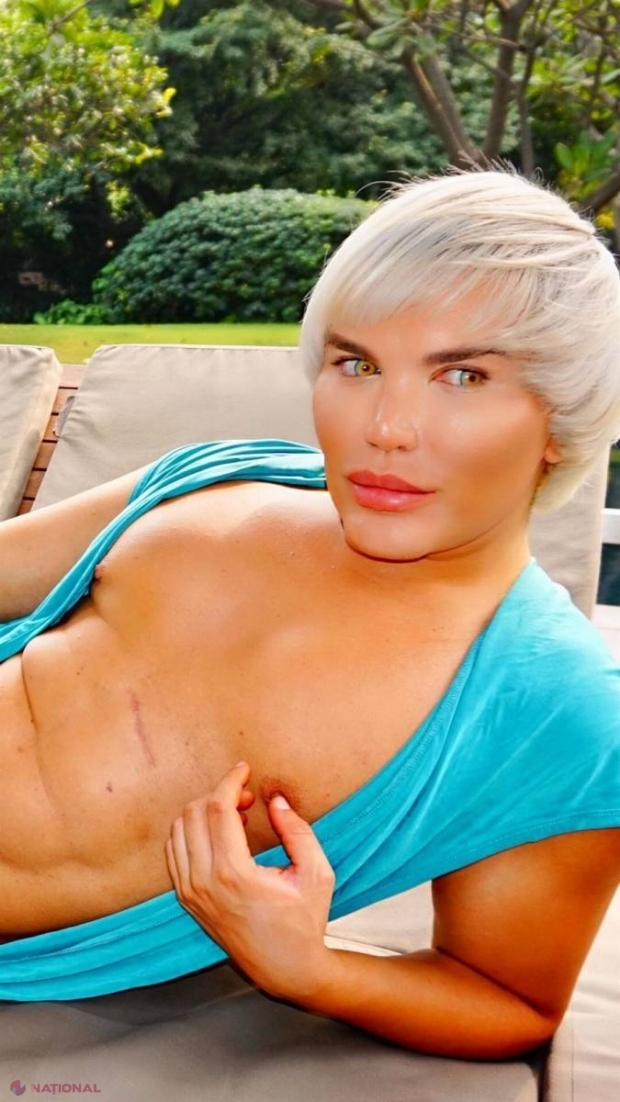Ce bărbat SIMPATIC era înainte de operaţiile estetice Rodrigo Alves, cunoscut şi ca păpuşa umană Ken