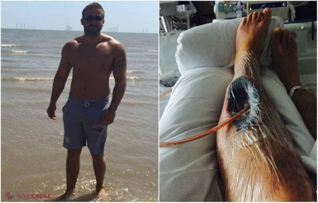 TERIFIANT //  Un bărbat s-a „PRĂJIT” pe interior după ce a luat „fat burners” (FOTO)