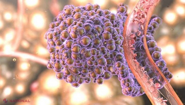 TRATAMENTUL pentru cancer EXISTĂ de 100 de ani. A fost ţinut ASCUNS până acum!