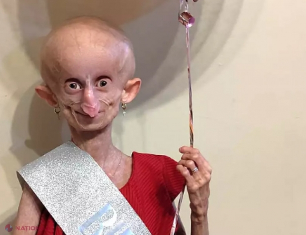 O vedetă TikTok a murit la doar 19 ani din cauza unei boli foarte rare care afectează doar câteva sute de persoane din toată lumea