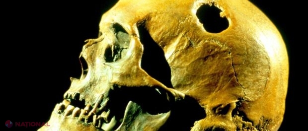 CURIOS // De ce își făceau găuri în craniu strămoșii noștri