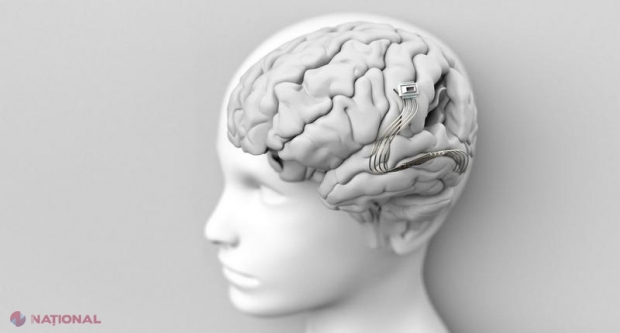 Neuralink, start-up-ul lui Elon Musk, a implantat primul microcip în creierul unui om