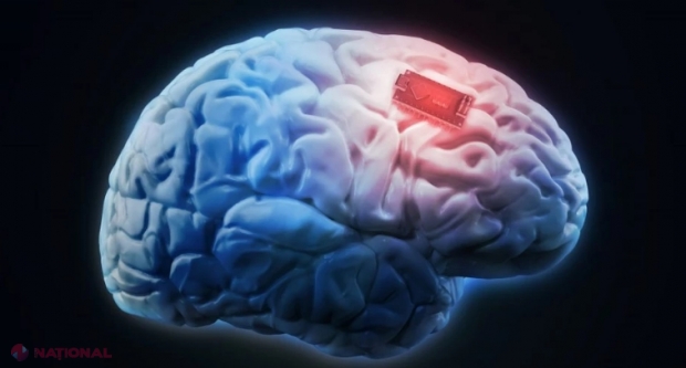 EXPERIMENT // Un implant cerebral a tradus gândurile unui bărbat paralizat cu acuratețe de 94%