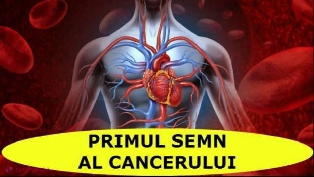 Primul semn al CANCERULUI. Nu ignora aceste simptome