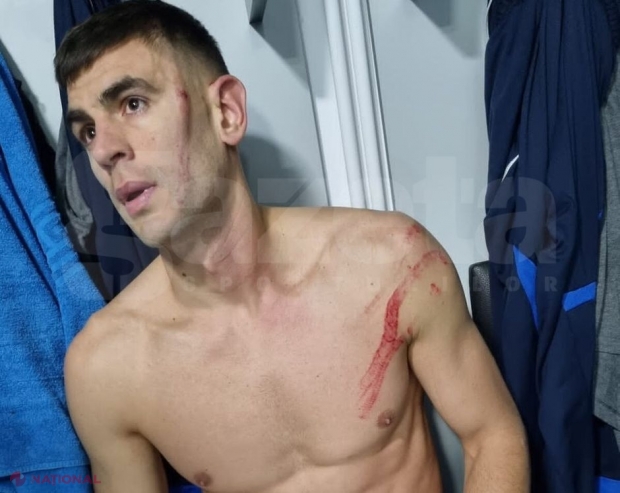 VIDEO // „Gladiatorul” Igor Armaș, la un pas de o mare tragedie. Un atacant de la FCSB a avut o intrare CRIMINALĂ asupra fostului internațional moldovean: „Igor s-a dezbrăcat în vestiar și plângea de durere”