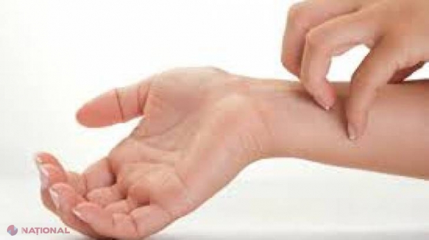 Semnele de alarmă care anunță CANCERUL de piele