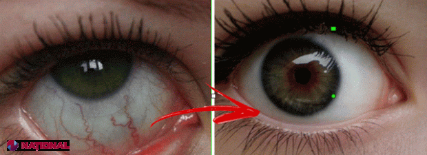 de ce se îmbunătățește vederea exerciții oculare video de restaurare a vederii