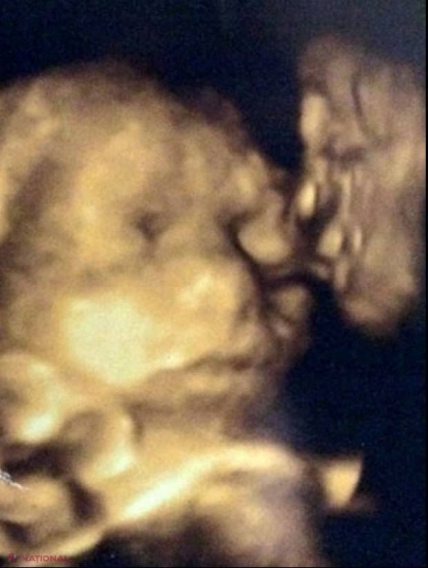 Șocul unei femei însărcinate, când a văzut ECOGRAFIA