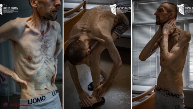 Imagini șocante cu un prizonier ucrainean după doi ani de captivitate în Rusia. „Evocă cele mai întunecate pagini ale istoriei umane”
