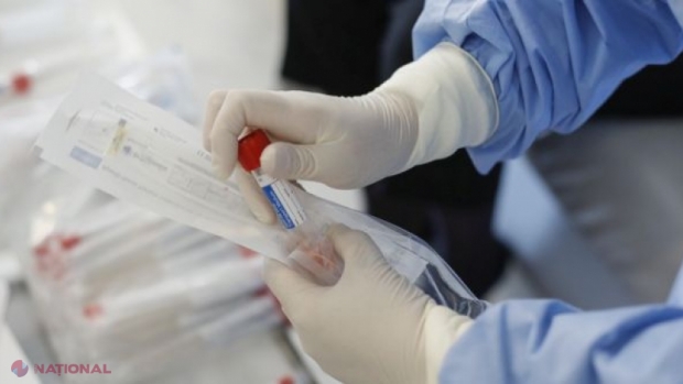 COVID-19: A apărut testul rapid pentru detectarea noului coronavirus, cu o eficiență de 94%