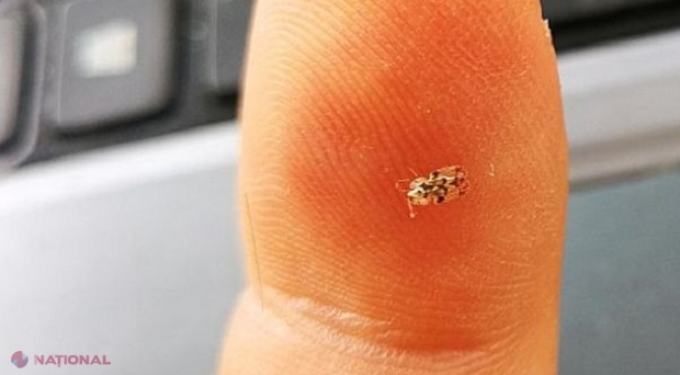 Reacția autorităților vizavi de insectele necunoscute care au ajuns la noi și îngrijorează cetățenii R. Moldova