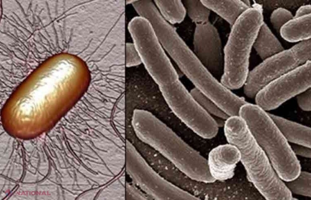 cistita sau infectie urinara