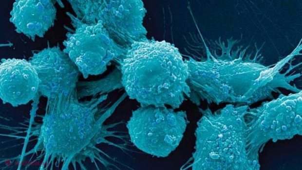 Remediul neaşteptat pentru cancer. Îl avem în bucătărie şi nu ştiam  