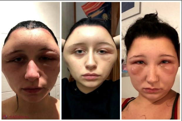 FOTO, VIDEO // Și-a aplicat vopsea pe păr acasă și era să moară. Greșeala pe care multe femei o fac în timpul pandemiei