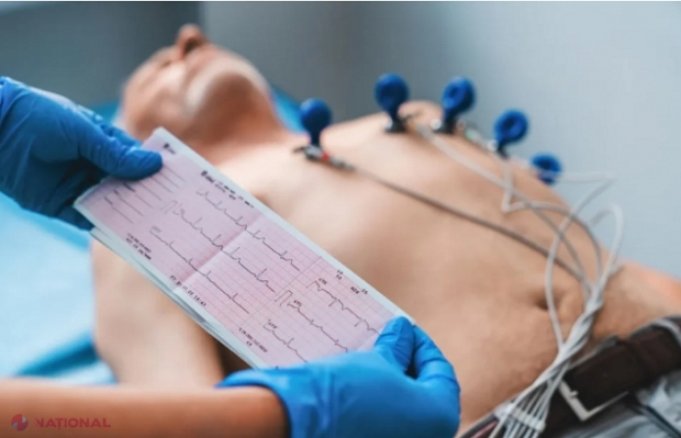 S-a dus cu ambulanța acasă la un pacient și, în loc să-l transporte la spital, i-a recomandat să se adreseze la medicul de familie. Pacientul a decedat în scurt timp, iar felcerul a fost condamnat la închisoare cu suspendarea executării pedepsei