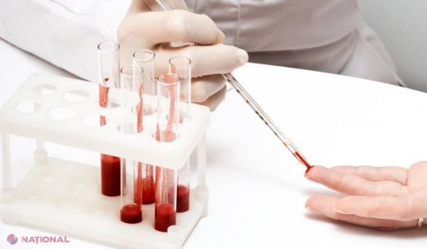 HIV şi sifilis, depistate în 15 minute, cu ajutorul unui accesoriu pentru telefoanele inteligente