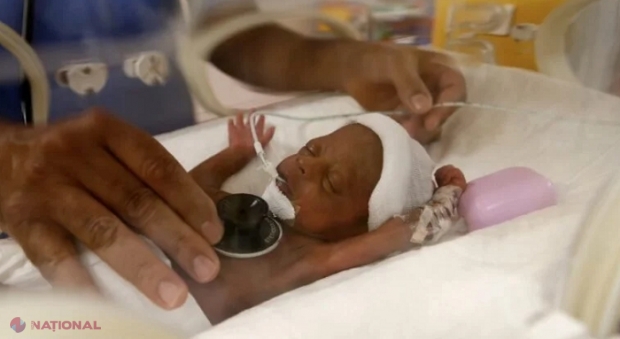 O mamă de 25 de ani a născut NOUĂ copii odată. Cum arată la un an singurii nanopleți din lume