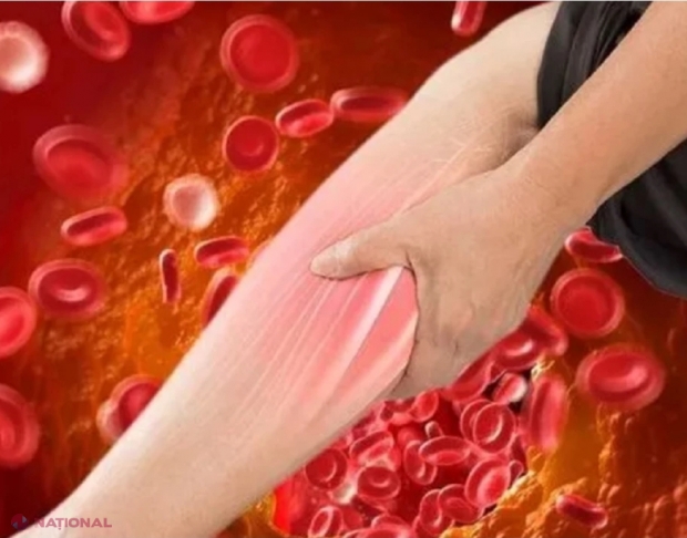 Ce îți spune mersul pe jos despre colesterol. Nu ignora ACESTE 5 semne alarmante care pot apărea atunci când faci o plimbare