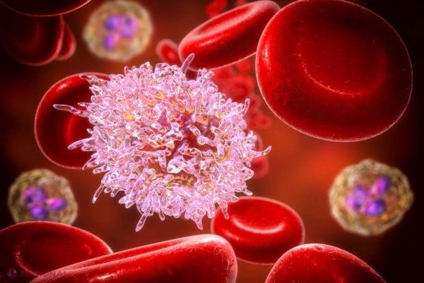 Tratamentul REVOLUȚIONAR care vindecă leucemia. Doi pacienţi sunt în remisiune la zece ani după ce au început terapia cu celule CAR-T