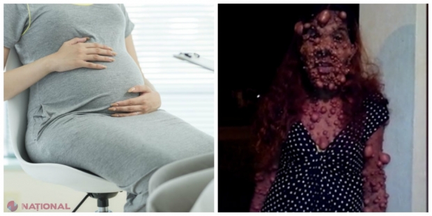 Femeia care arată precum un monstru după ce a născut al doilea copil