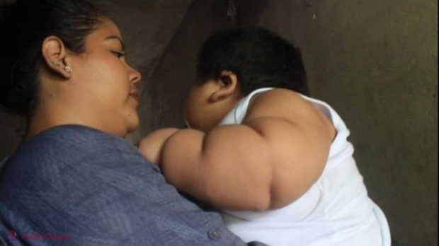 VIDEO // Bebeluşul fenomen: la 10 luni cântăreşte cât un copil de nouă ani. Mama a crezut că are „lapte hrănitor”