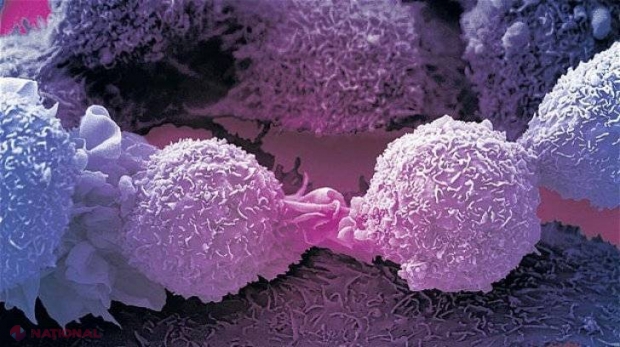 Alimentul care AJUTĂ la apariția cancerului. Îl mâncăm zilnic  